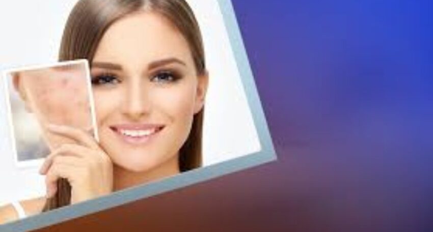 Fractional Laser Scar Session