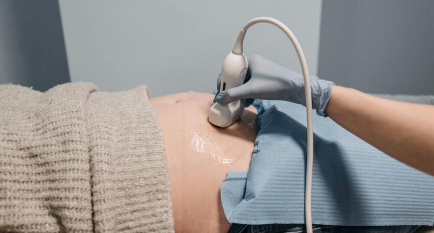 Stretch Mark Treatment